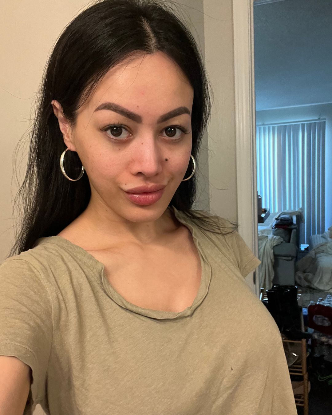 skin lightening journey, hydroquinone before and after, glutathione skin results, Musely Dark Spot Cream review, even skin tone skincare, hyperpigmentation treatment, dark spots removal, glutathione whitening serum, skincare for melasma, how to lighten dark areas on face, best products for skin discoloration, natural glowing skin routine, no makeup confidence, skincare transformation, hormonal pigmentation fix, best cream for uneven skin tone, Korean beauty brightening products